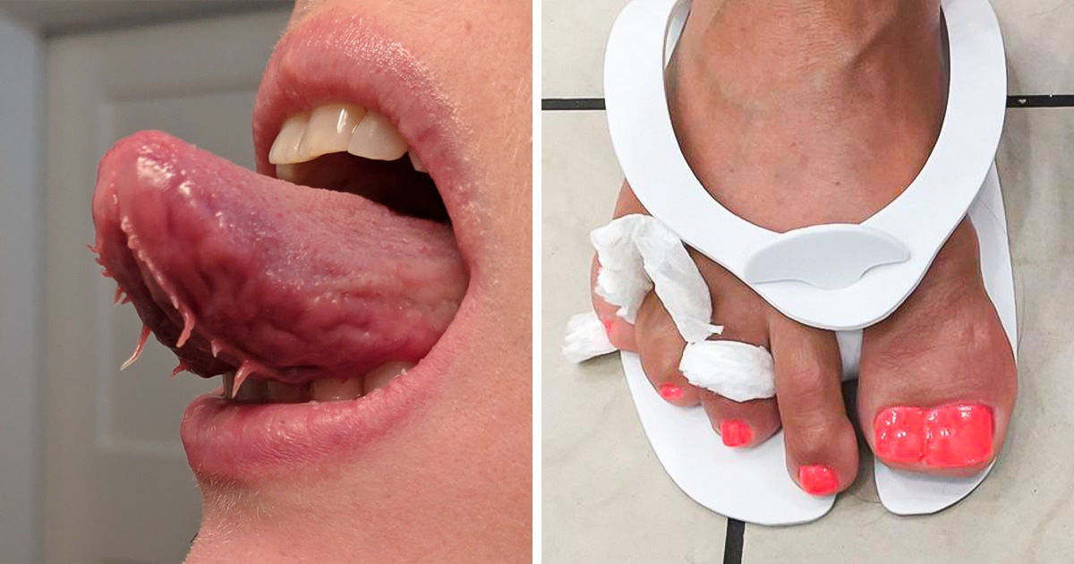 19 Personnes avec des particularités physiques qui les rendent uniques