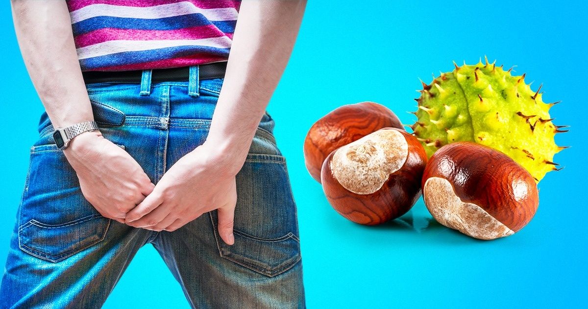 Découvre ces 11 manières de traiter les problèmes liés aux hémorroïdes sans forcément recourir à la chirurgie