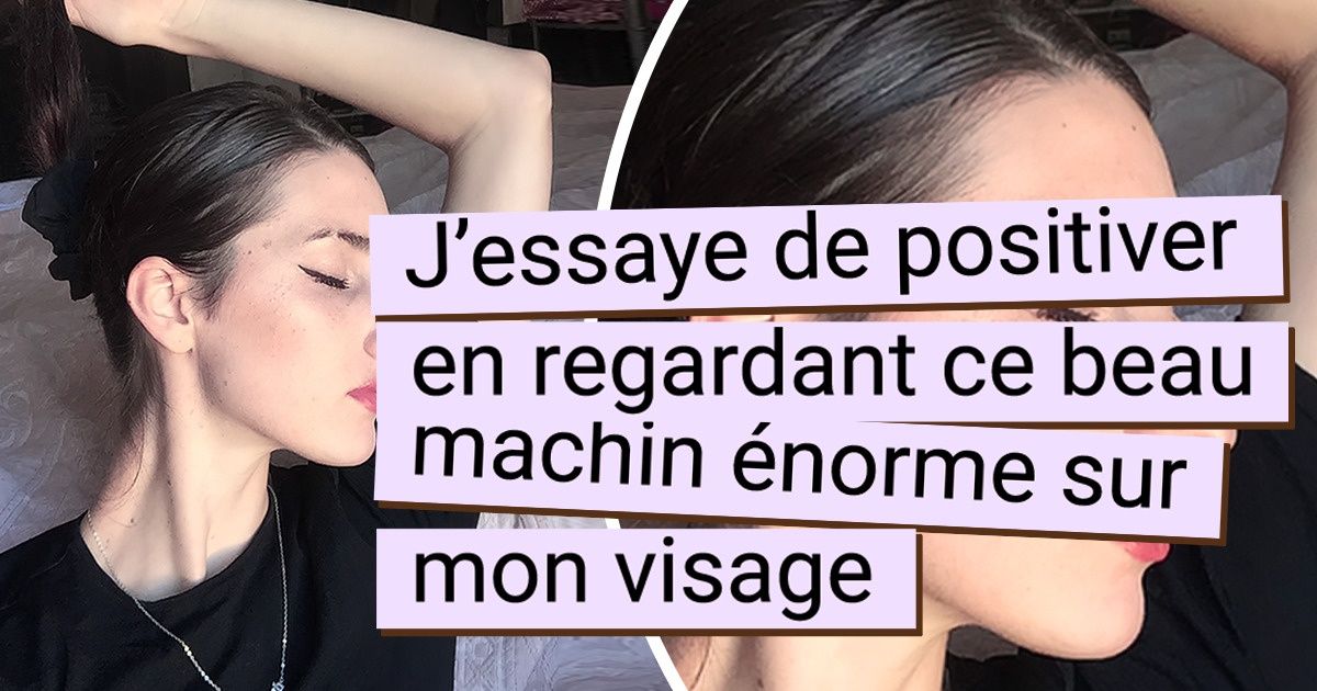 16 Personnes qui ont fini par accepter leurs petites imperfections