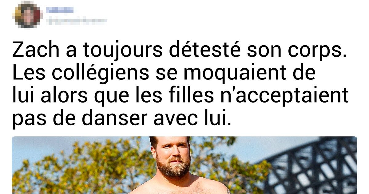 13 Personnes avec une beauté atypique qui ont su conquérir le public
