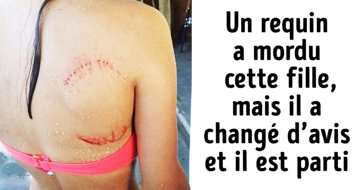 25 personnes qui ont vraiment eu beaucoup de chance