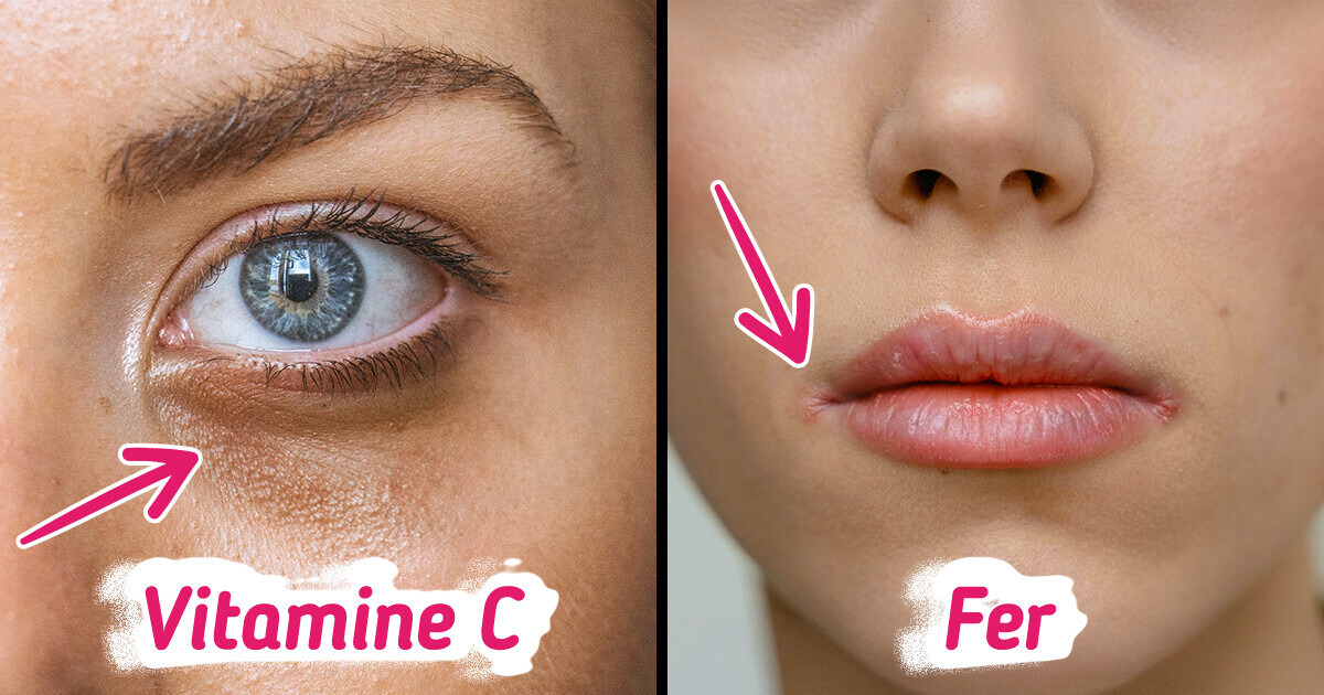 5 Carences nutritionnelles chez les femmes qui pourraient te voler ta beauté