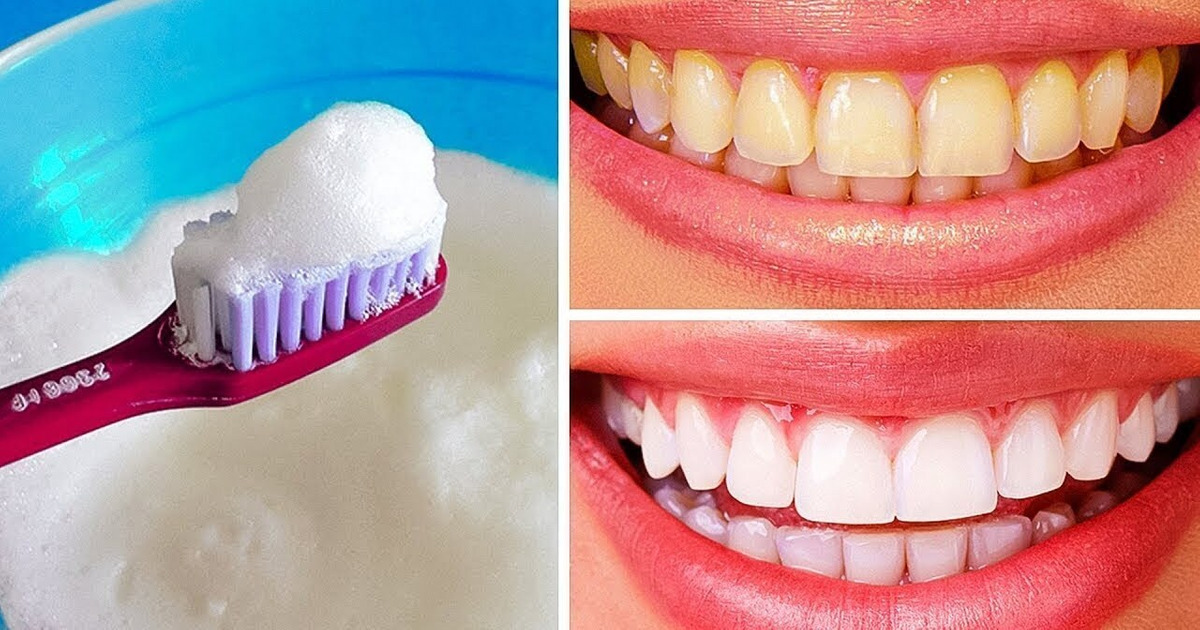 10 Des Meilleurs Moyens Pour Naturellement Blanchir Tes Dents à la Maison