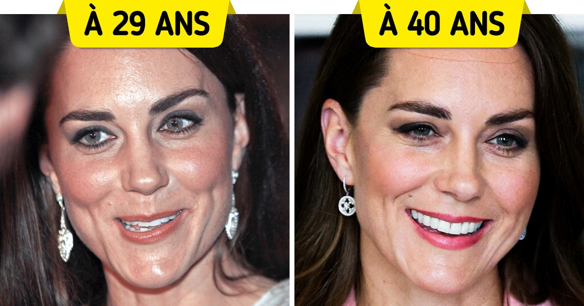 17 Visages royaux et leur évolution au fil du temps