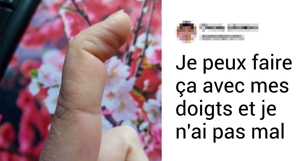 14 Personnes dont l’apparence unique restera gravée dans ta mémoire pendant longtemps 14 Personnes dont l’apparence unique restera gravée dans ta mémoire pendant longtemps