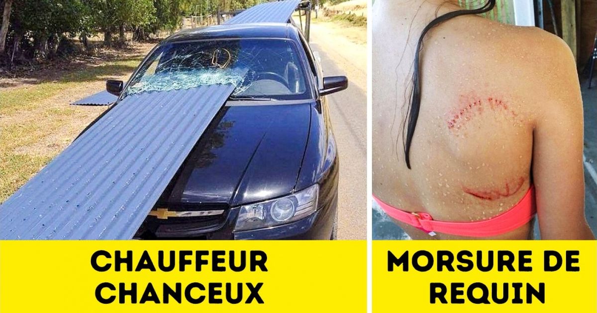 Ces 20 personnes ont trompé la mort et ont pu raconter leur histoire !