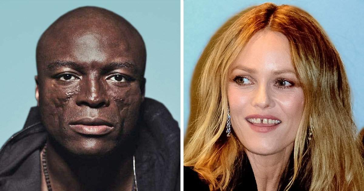 10 Célébrités dont les traits de visages uniques font leur beauté