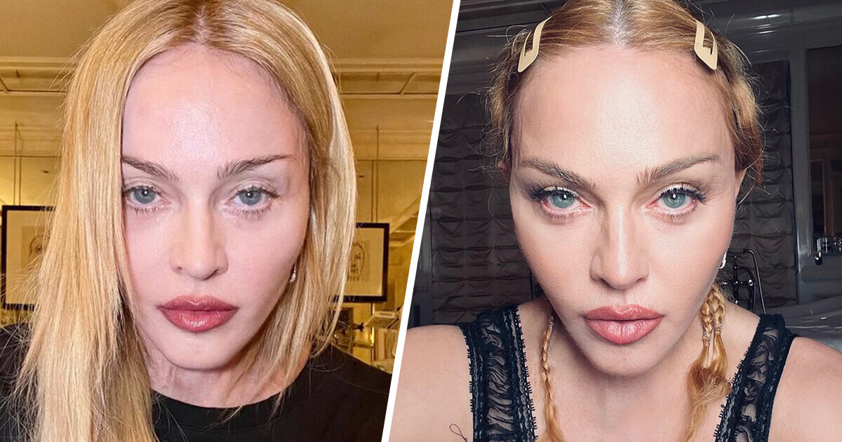 Les fans très inquiets suite aux confessions bouleversantes de Madonna lors d’un concert Les fans très inquiets suite aux confessions bouleversantes de Madonna lors d’un concert