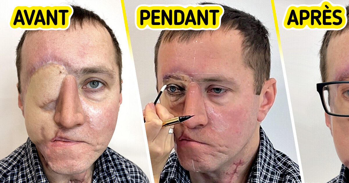 Cette artiste tatoue un œil permanent à cet homme défiguré après un tragique accident