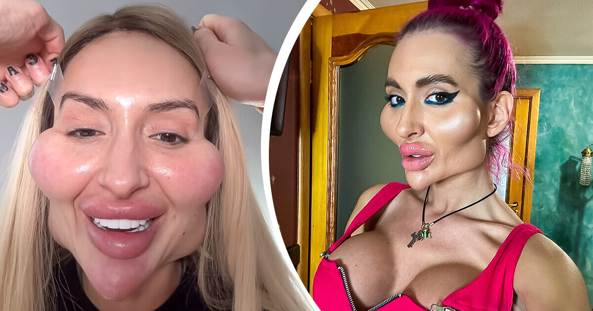 La femme avec les plus grosses joues du monde répond aux gens critiquant son look