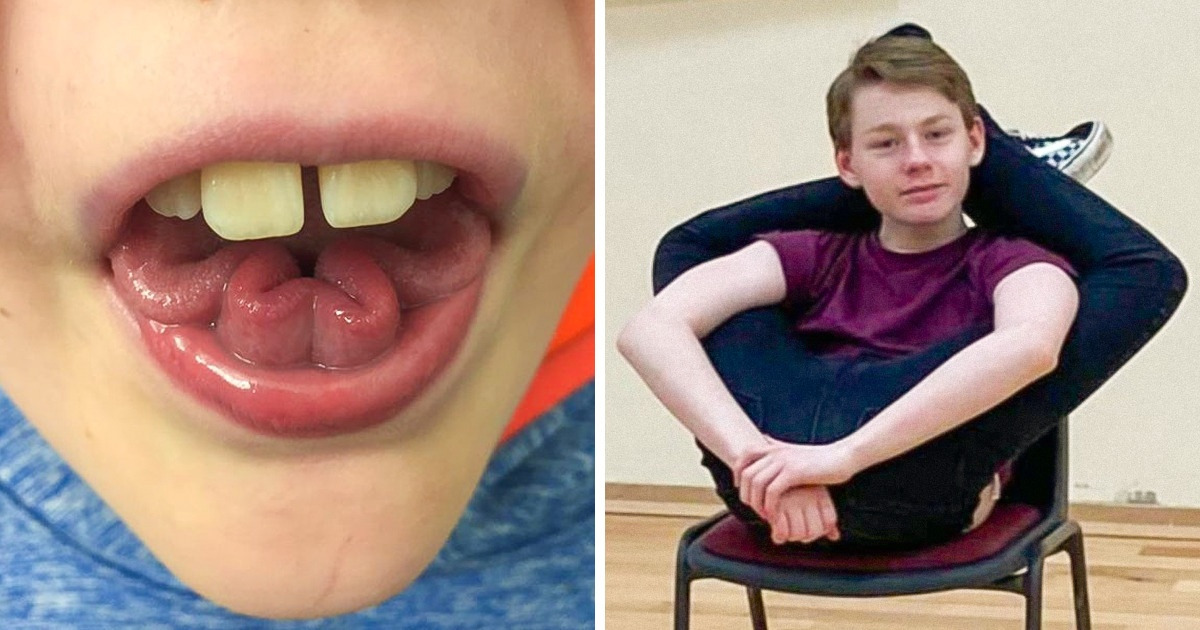 20 Enfants pour qui les normes de beauté classiques ne s’appliquent pas