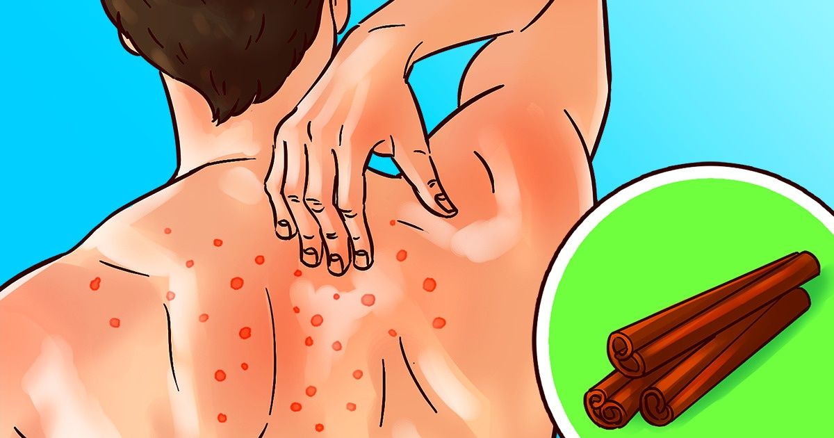 10 Herbes et épices pour prendre soin de ton corps de la tête aux pieds