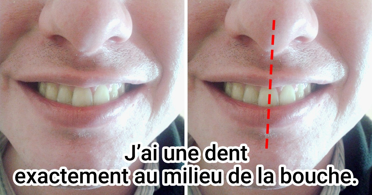 15+ Caractéristiques corporelles surprenantes que la plupart des gens n’ont pas