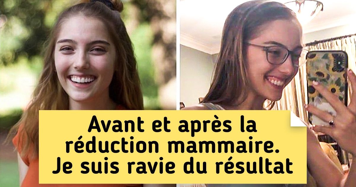 20+ Photos “avant” et “après” qui montrent un résultat vraiment impressionnant 20+ Photos “avant” et “après” qui montrent un résultat vraiment impressionnant