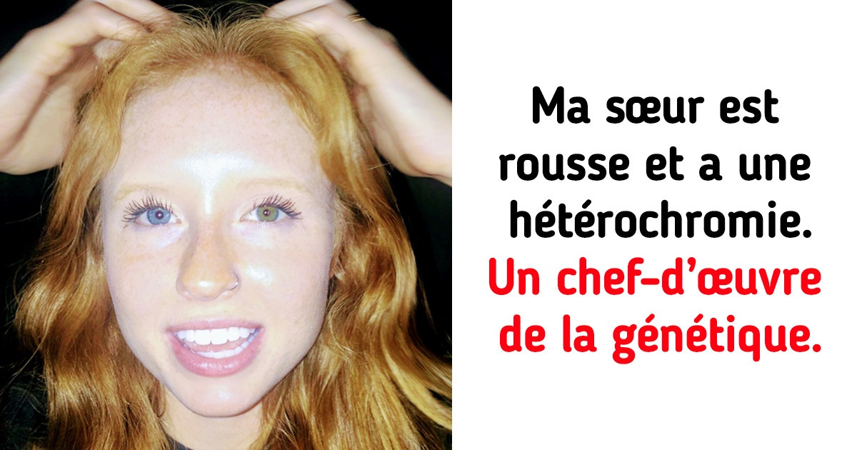 14 Personnes aux caractéristiques uniques qui montrent pourquoi elles peuvent en être fières