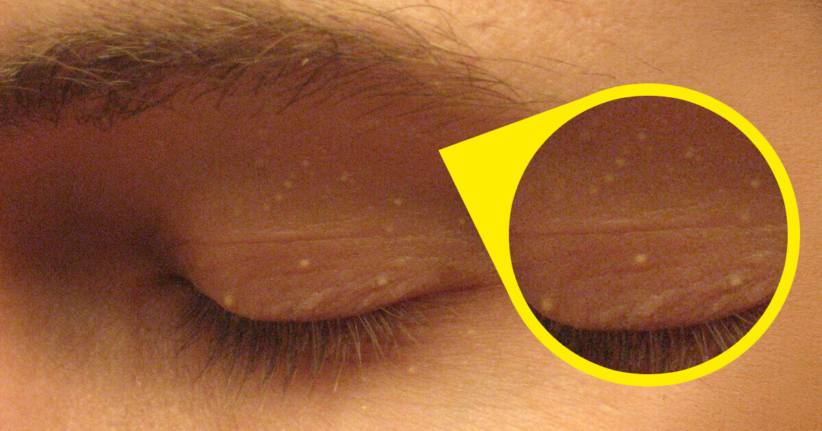 4 Signes discrets sur ton visage qui en disent long sur ta santé 4 Signes discrets sur ton visage qui en disent long sur ta santé