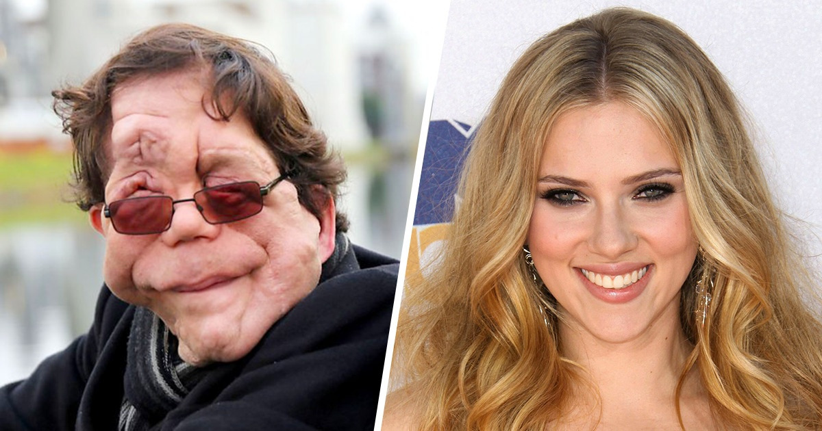L’acteur qui a brisé tous les paradigmes malgré la maladie et partagé l’écran avec Scarlett Johansson