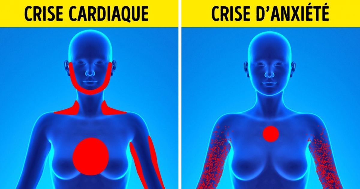 Decouvre Differentes Facons De Distinguer Une Crise Cardiaque D Une Crise D Anxiete