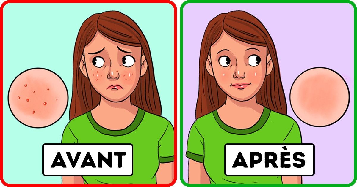 Qu’arrivera-t-il à ton corps si tu inclus des graines de papaye dans ton alimentation quotidienne ? Qu’arrivera-t-il à ton corps si tu inclus des graines de papaye dans ton alimentation quotidienne ?