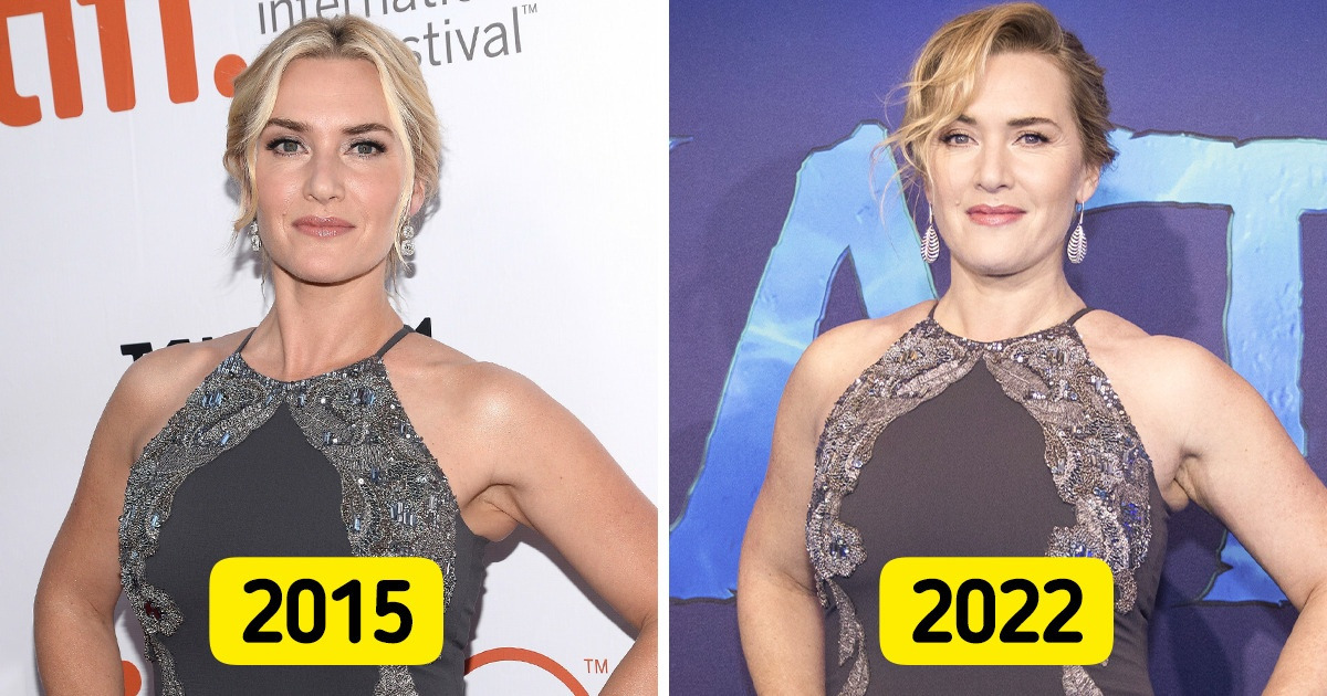 8 Stars qui prouvent qu’on peut briller plusieurs fois avec le même look