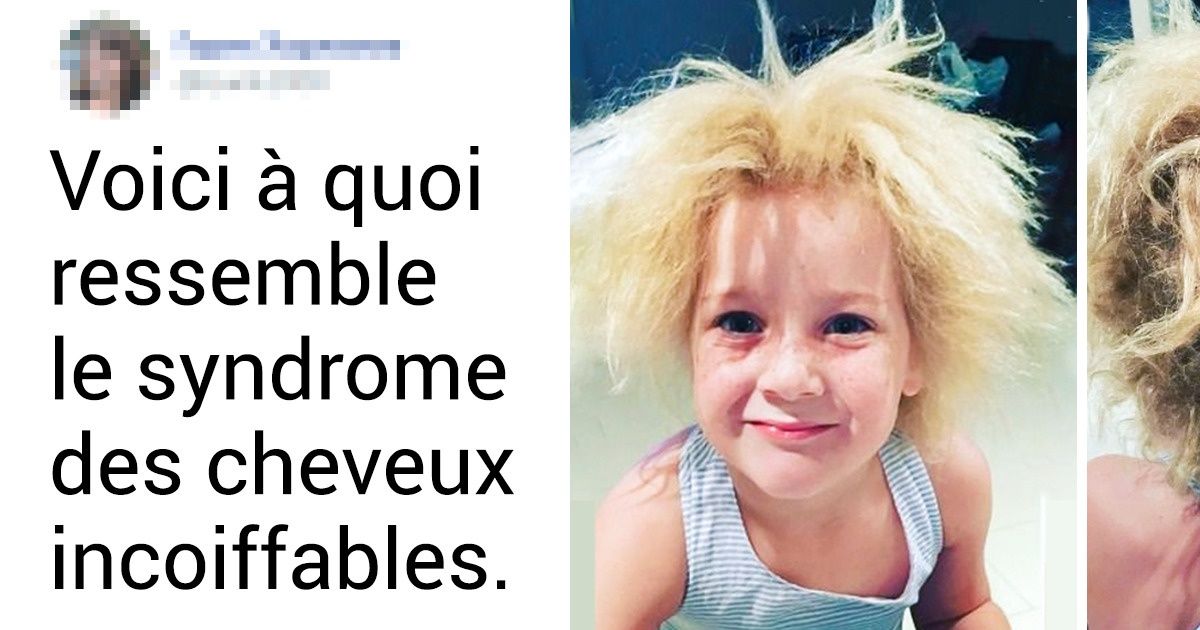 20+ Personnes au physique exceptionnel qui ont imposé leurs propres critères de beauté 20+ Personnes au physique exceptionnel qui ont imposé leurs propres critères de beauté