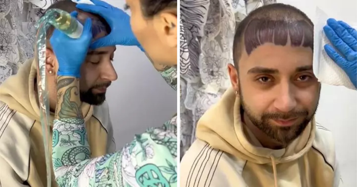 Un homme atteint de calvitie a décidé de se faire tatouer une frange Un homme atteint de calvitie a décidé de se faire tatouer une frange