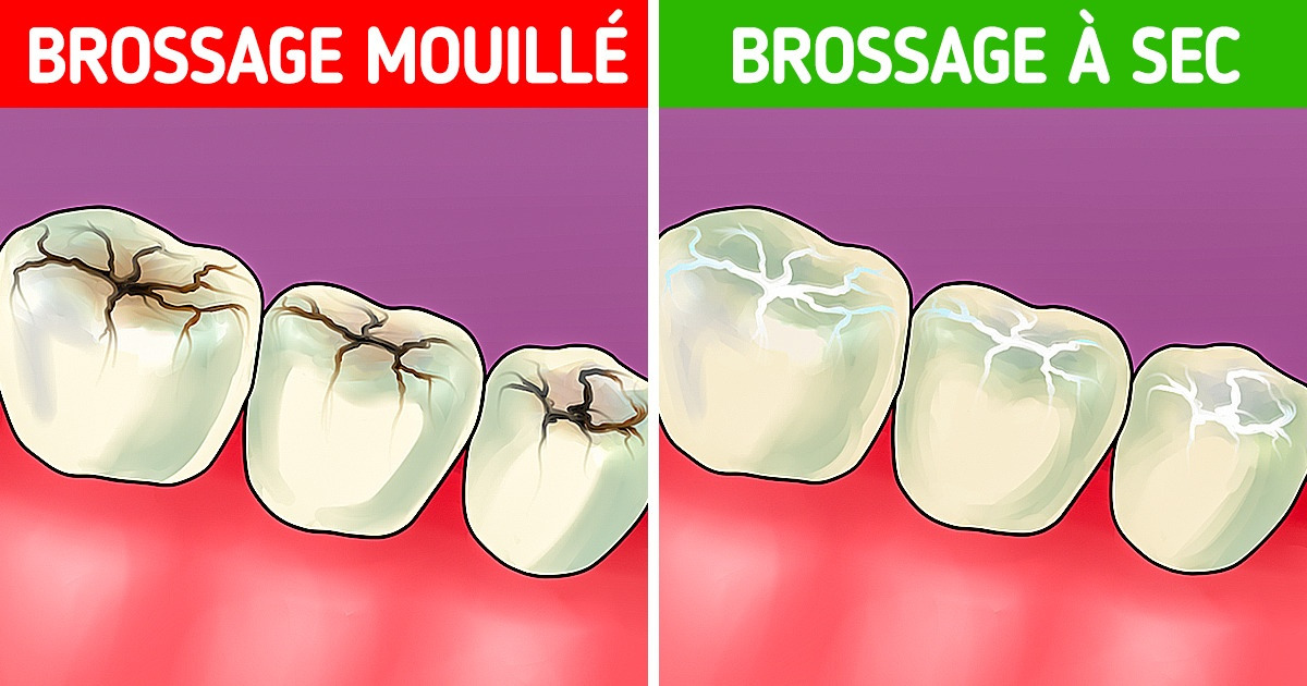 9 Conseils de soins dentaires que tu ignorais probablement jusqu’à aujourd’hui 9 Conseils de soins dentaires que tu ignorais probablement jusqu’à aujourd’hui