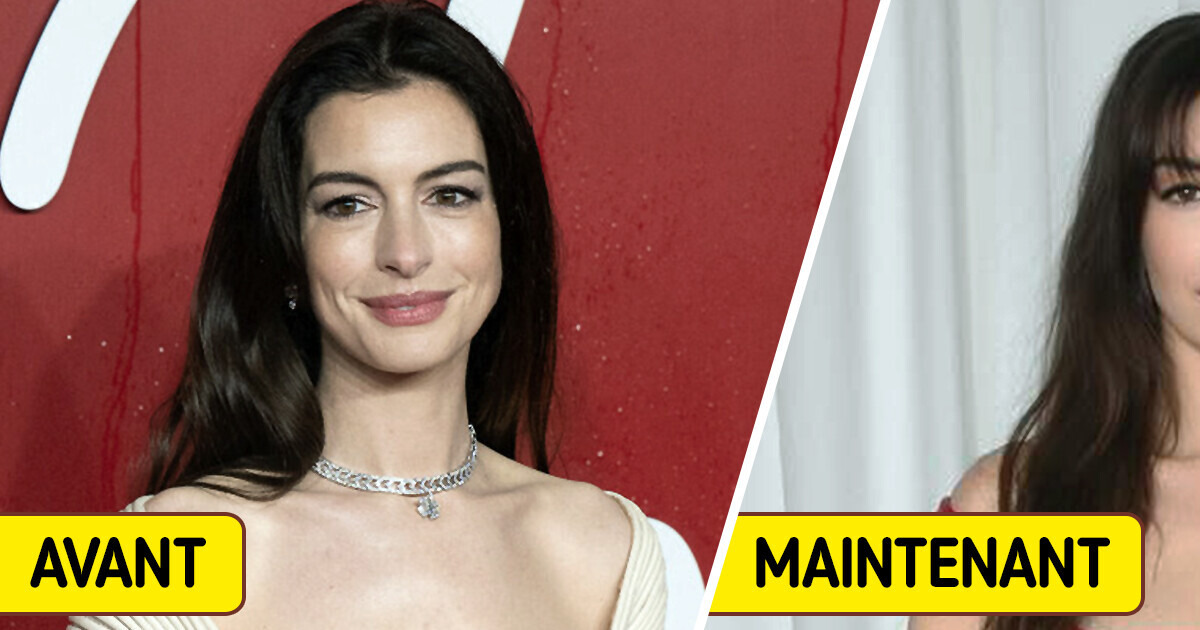 «Presque méconnaissable», l’apparence d’Anne Hathaway choque les fans «Presque méconnaissable», l’apparence d’Anne Hathaway choque les fans