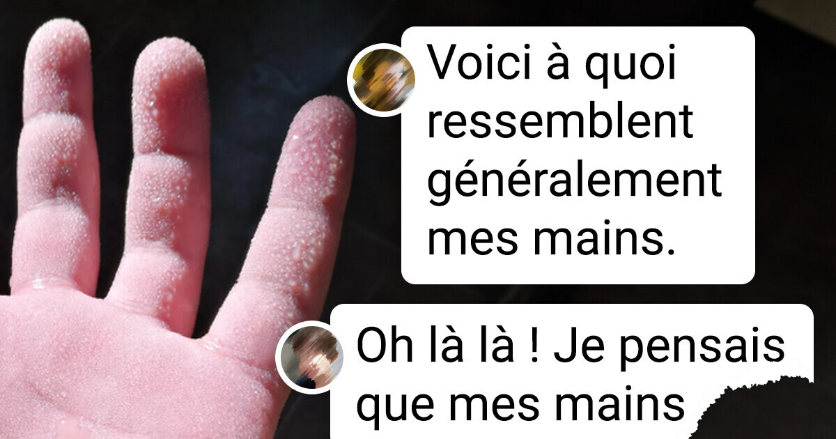 18 Photos qui montrent que la génétique offre parfois un résultat totalement inattendu