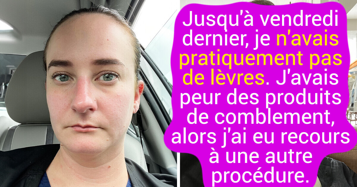 14 Personnes ont révélé ce qu’elles avaient fait pour transformer leur apparence 14 Personnes ont révélé ce qu’elles avaient fait pour transformer leur apparence