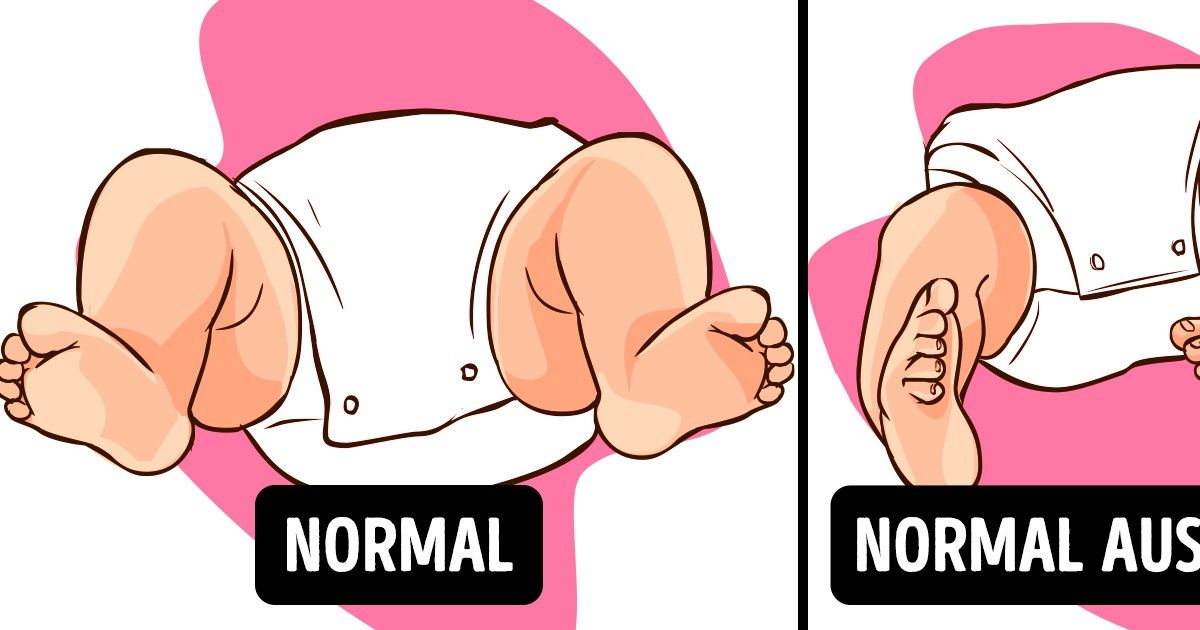 Problèmes de jambes courants chez les enfants dont les parents ne devraient pas s’inquiéter