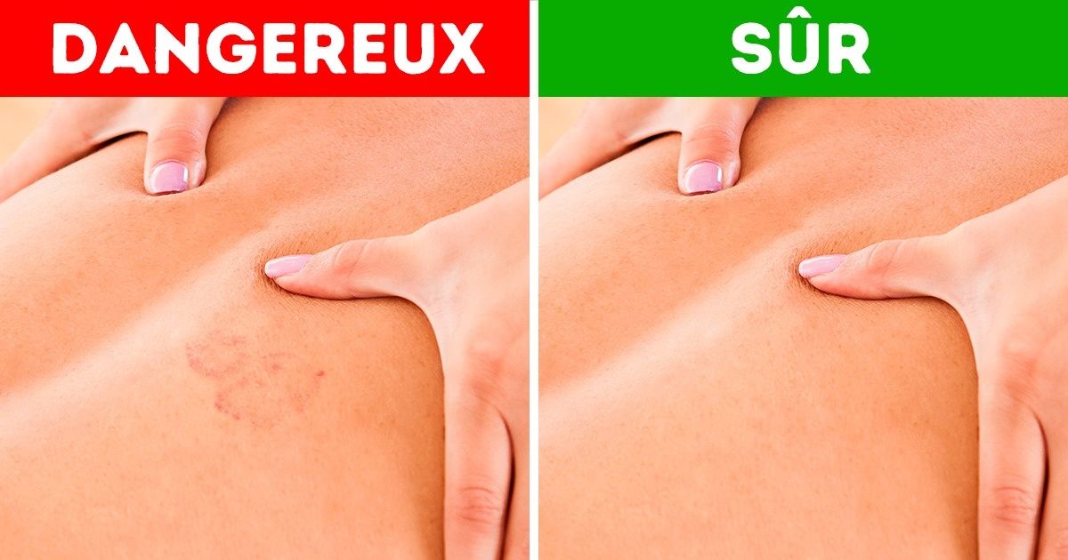 Découvre comment réaliser un massage simple, efficace et digne d’un véritable professionnel Découvre comment réaliser un massage simple, efficace et digne d’un véritable professionnel