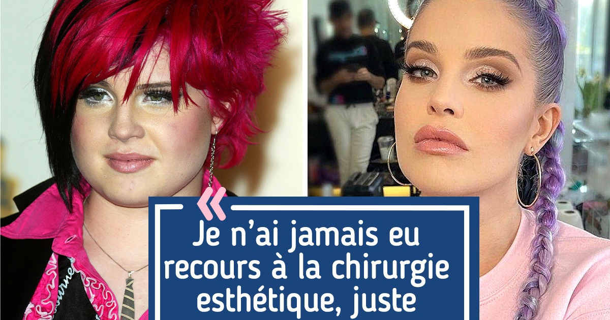 15 Célébrités dont les visages sont sublimes sans retouche, peu importe les rumeurs