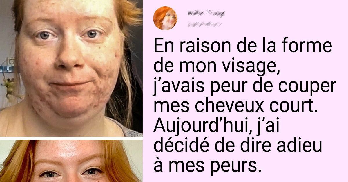13+ Personnes qui ont accepté leurs défauts et ont commencé à profiter de leur vie à fond