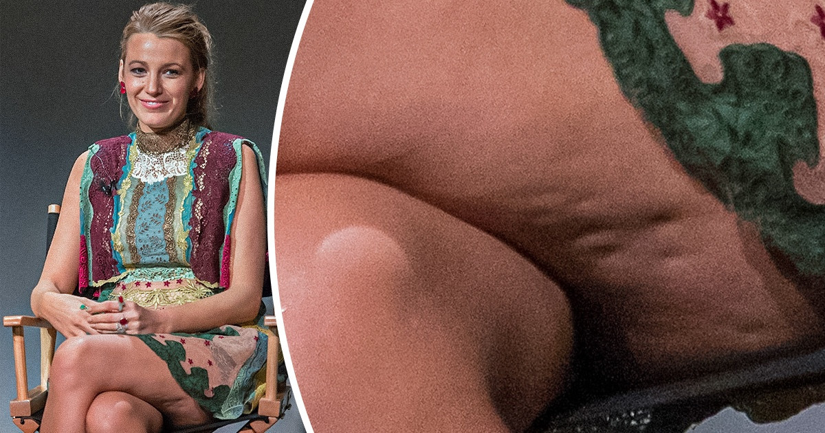 17 Stars qui affichent sans complexe des imperfections d’un corps féminin