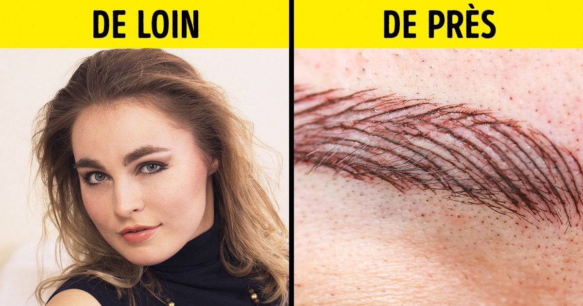 9 Procédés pratiqués dans les instituts de beauté que les dermatologues ne recommandent pas