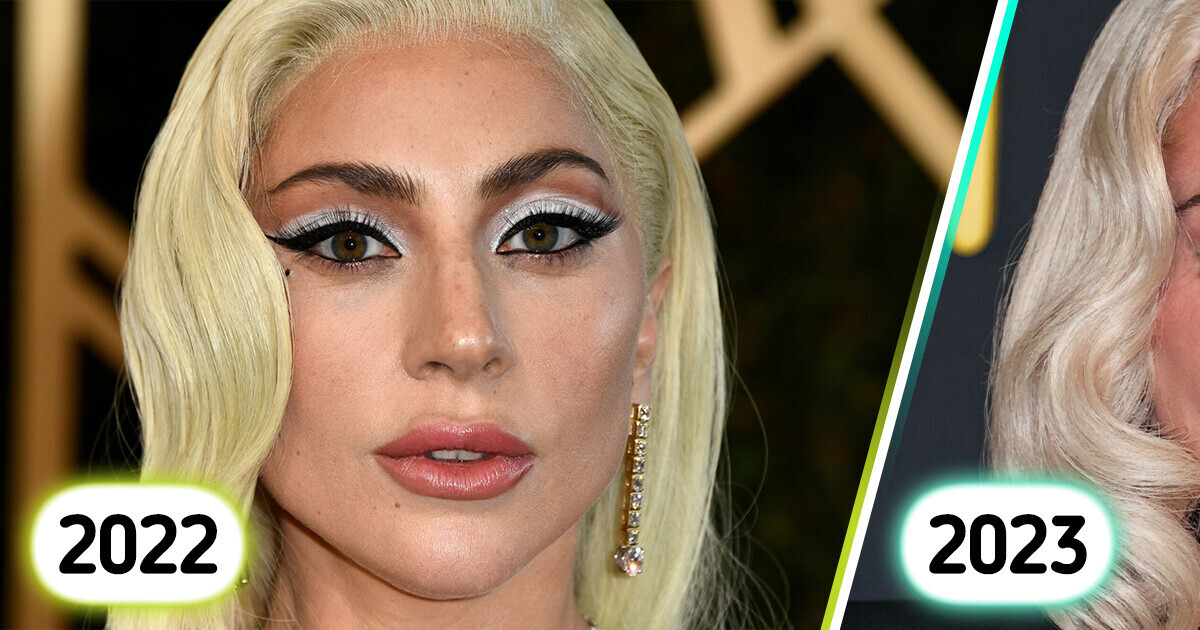 “Elle doit laisser son visage tranquille”, la dernière apparition de Lady Gaga suscite la controverse “Elle doit laisser son visage tranquille”, la dernière apparition de Lady Gaga suscite la controverse