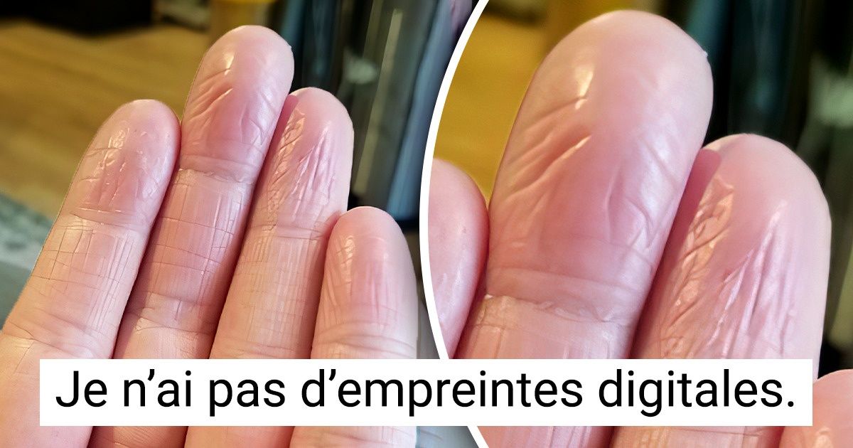 20 Personnes qui ont découvert quelque chose d’unique sur leur corps