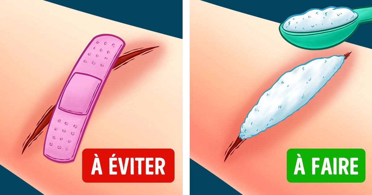 11 Astuces de premiers secours qui pourraient te sauver la vie 11 Astuces de premiers secours qui pourraient te sauver la vie