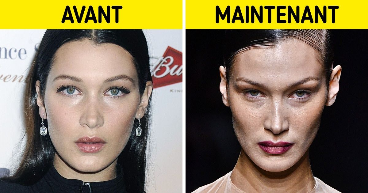 Nous avons comparé les photos de 17 célébrités : sur les unes, elles ont des joues potelées, et sur les autres, des pommettes ciselées Nous avons comparé les photos de 17 célébrités : sur les unes, elles ont des joues potelées, et sur les autres, des pommettes ciselées