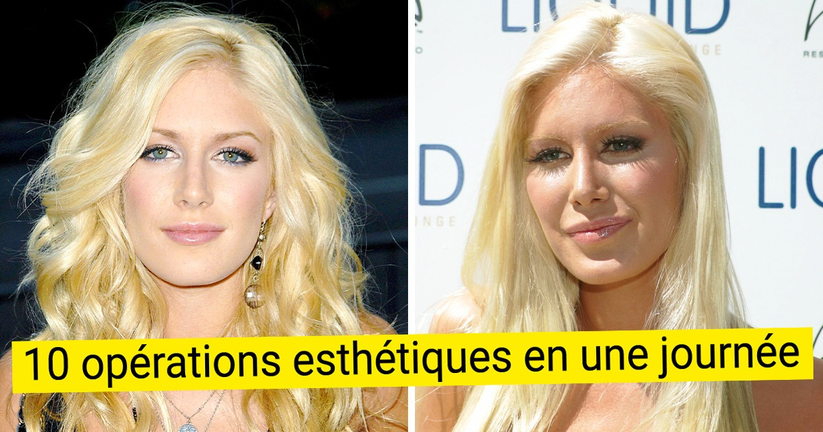 10 Célébrités qui regrettent le bistouri et dont certaines ont fait marche arrière