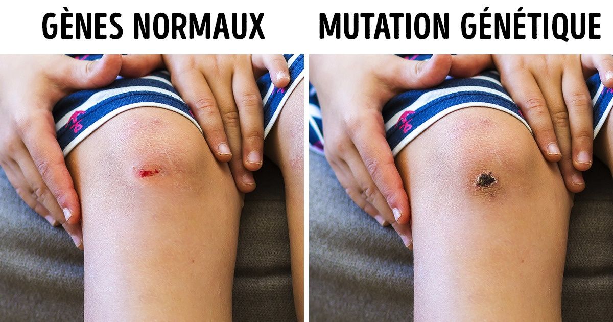 11 moyens scientifiques pour freiner le vieillissement et augmenter la longévité 11 moyens scientifiques pour freiner le vieillissement et augmenter la longévité