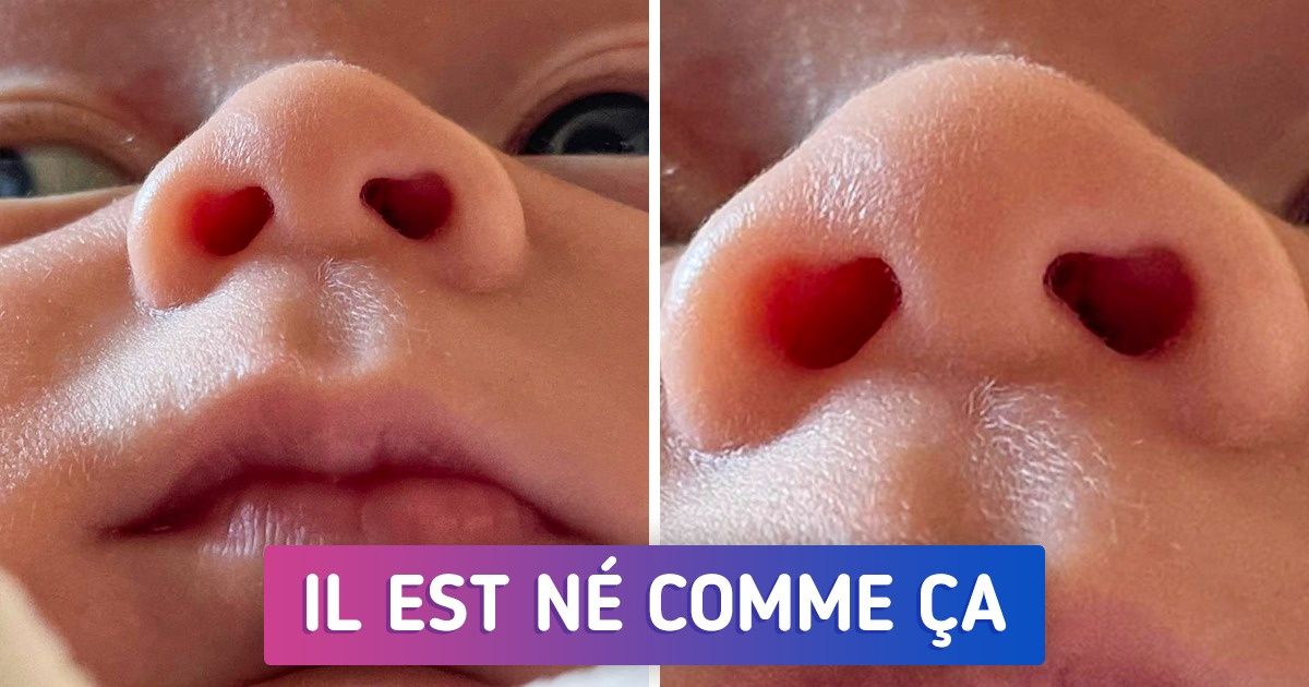 20 Fois où la nature a été créative et a façonné des êtres aux traits uniques 20 Fois où la nature a été créative et a façonné des êtres aux traits uniques