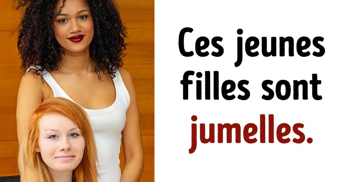 Voici 20 photos qui prouvent que les gênes sont imprévisibles