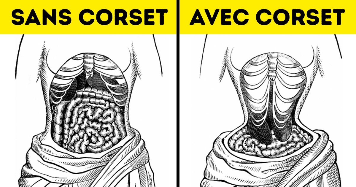 9 Phénomènes de mode déconcertants de l’époque victorienne 9 Phénomènes de mode déconcertants de l’époque victorienne