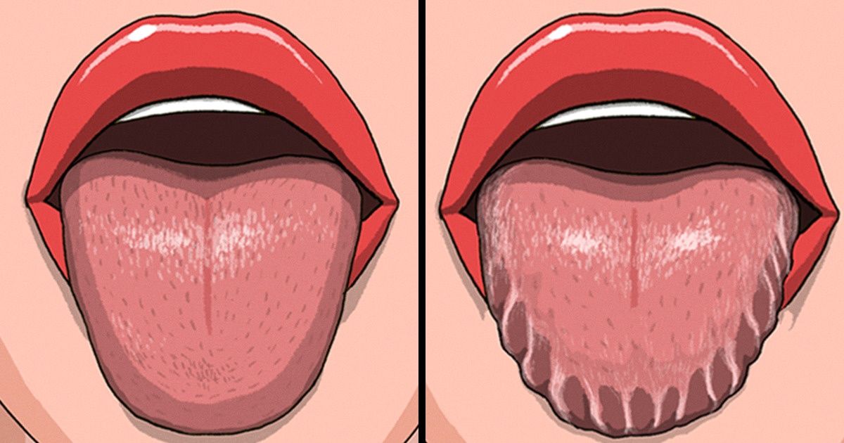 10 Changements dans ton corps qui peuvent en dire long sur ta santé 10 Changements dans ton corps qui peuvent en dire long sur ta santé
