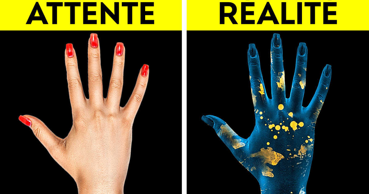 Notre corps ne peut pas être complètement propre, et c’est une bonne chose Notre corps ne peut pas être complètement propre, et c’est une bonne chose