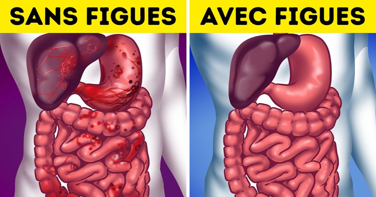 10 Bonnes raisons d’inclure les figues dans ton alimentation 10 Bonnes raisons d’inclure les figues dans ton alimentation