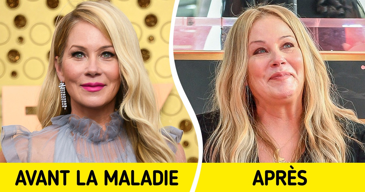 Voici l’histoire émouvante de Christina Applegate qui doit s’habituer à vivre avec sa maladie