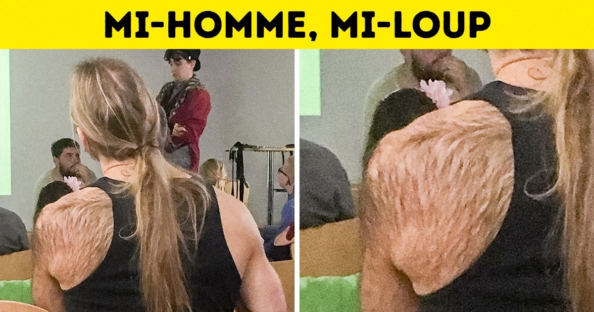 19 Internautes nous montrent fièrement les qualités uniques que la nature leur a données